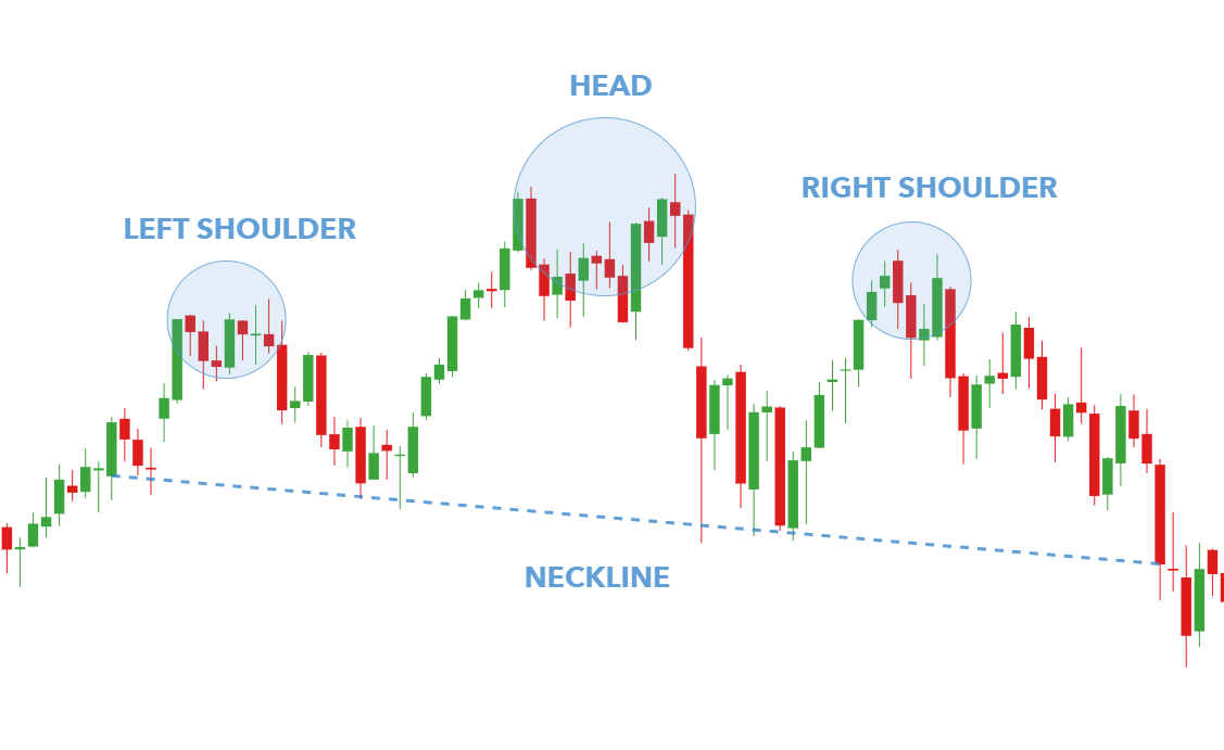 headandshoulders.png