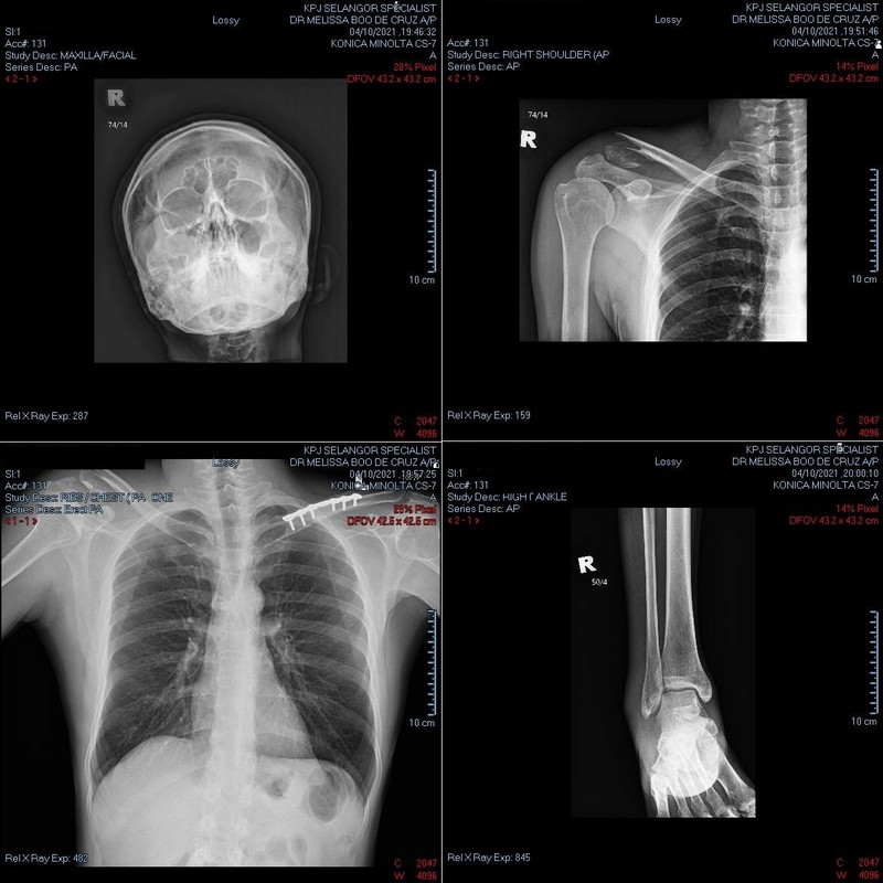 XRay.jpg